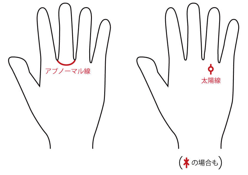 この手相の男性は浮気性 手相で見抜ける彼の恋愛事情 無料占いcoemi コエミ 当たる無料占いメディア